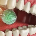 Treating the Underlying Cause of Bad Breath