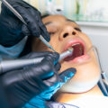 Everything You Need To Know About Dental Exams and Cleanings