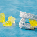 Limiting Sugary Foods and Drinks: Tips for Tooth Decay Prevention and Management
