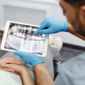 Cosmetic Dentistry Trends: Advancements and Innovations