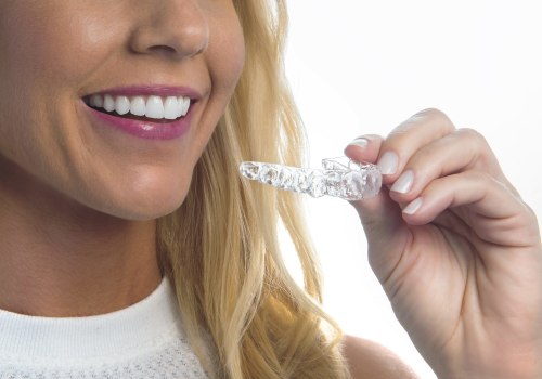 How long do you have to Wear SureSmile Aligners