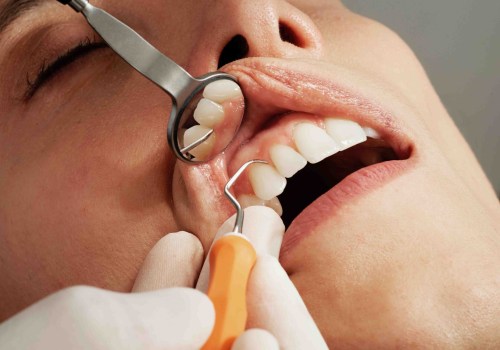 Popular Cosmetic Dentistry Treatments