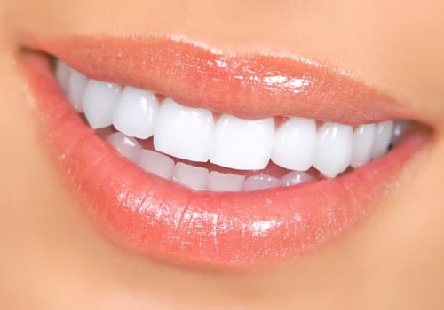 Is Teeth Whitening Safe for Your Enamel? Debunking Myths and Exploring the Facts