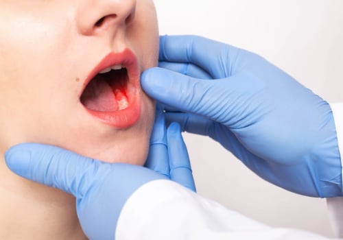 Medical Tests for Gum Disease